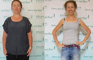 Katie featured in the National Press following her weight loss using PBT